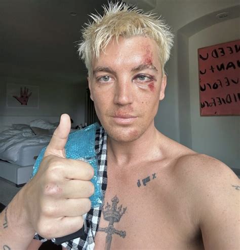 paul klein accident.